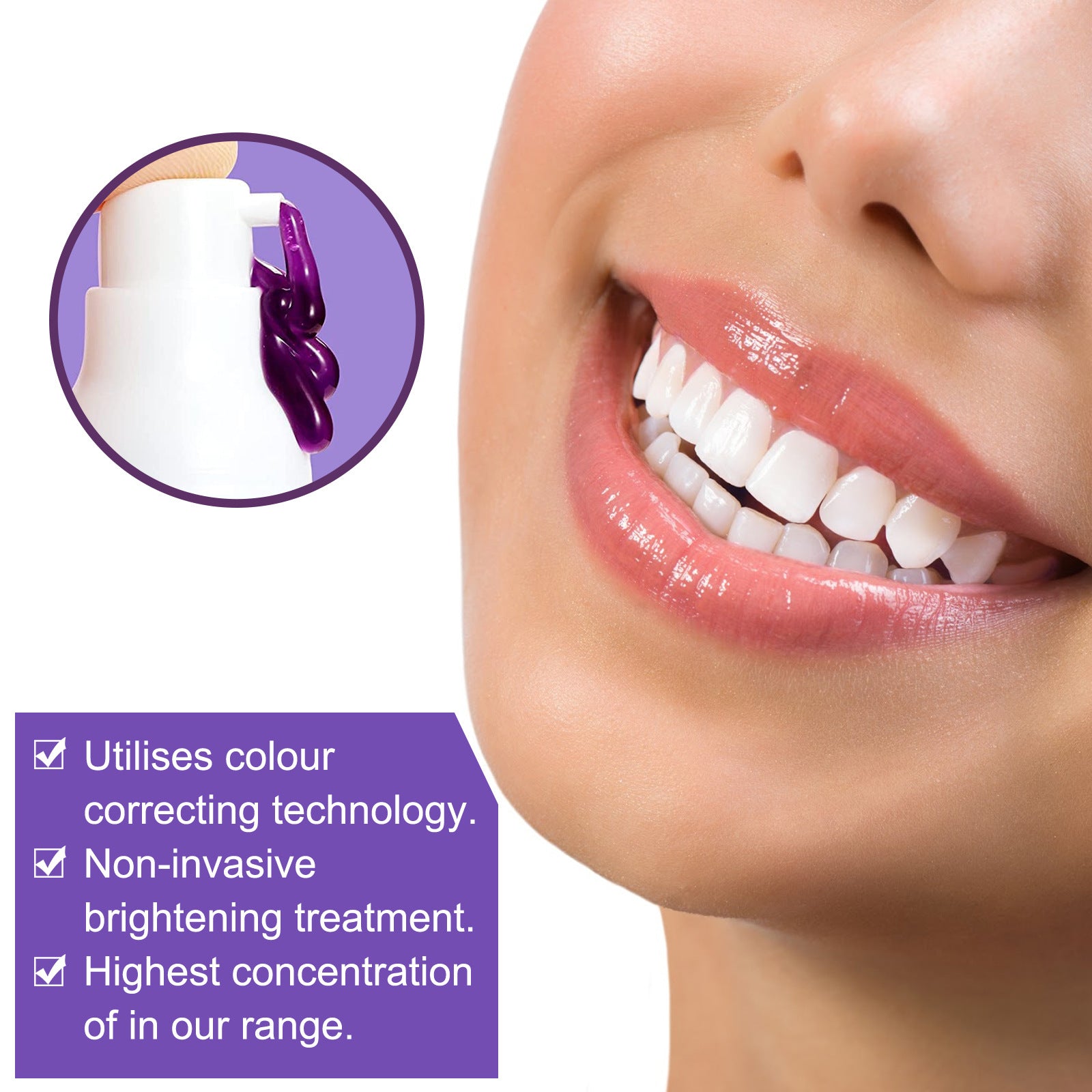 Dentiluz, Blanqueamiento Dental